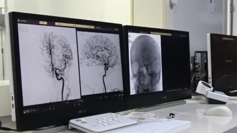 Araştırma Hastanesi'ne yeni nesil anjiyografi cihazı